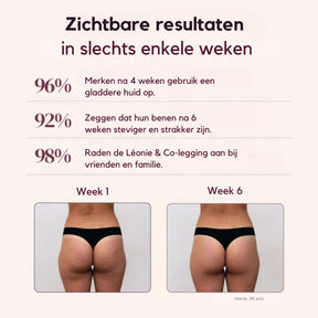 CurveLift™ – 3D-vormende leggings